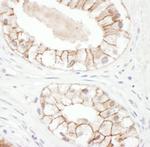 Plakoglobin Polyclonal Antibody