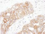 Plakoglobin Antibody in Immunohistochemistry (Paraffin) (IHC (P))