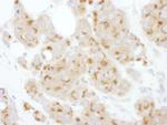 ATF6 Polyclonal Antibody