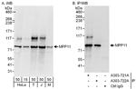 MPP11 Polyclonal Antibody
