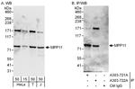 MPP11 Polyclonal Antibody