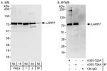 LARP7 Antibody in Western Blot (WB)