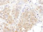 AS160 Polyclonal Antibody