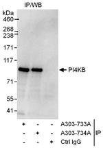 PI4KB Antibody in Immunoprecipitation (IP)