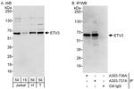 ETV3 Polyclonal Antibody