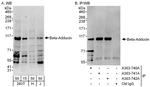 Beta-Adducin Polyclonal Antibody
