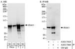 IRAK1 Polyclonal Antibody