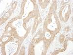 Beta-Arrestin 1 Polyclonal Antibody