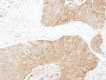 GPI Polyclonal Antibody