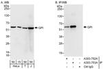 GPI Antibody in Western Blot (WB)