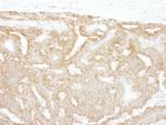 GPI Polyclonal Antibody