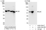 GPI Antibody in Western Blot (WB)