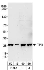 TPI1 Polyclonal Antibody