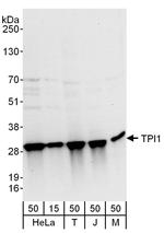 TPI1 Polyclonal Antibody