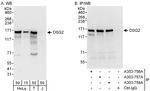 DSG2 Polyclonal Antibody