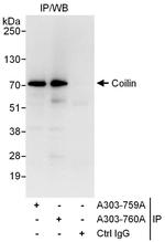 Coilin Antibody in Immunoprecipitation (IP)