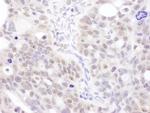 Coilin Polyclonal Antibody