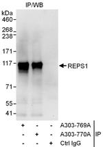 REPS1 Polyclonal Antibody