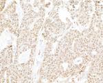 RPB3 Polyclonal Antibody