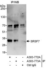 SRSF7 Antibody in Immunoprecipitation (IP)