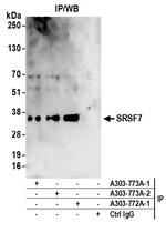 SRSF7 Antibody in Immunoprecipitation (IP)