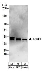 SRSF7 Antibody in Western Blot (WB)