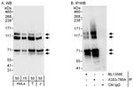 MAP7D1 Polyclonal Antibody