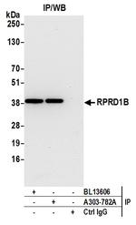 RPRD1B Antibody in Immunoprecipitation (IP)