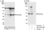 PDCD2L Antibody in Western Blot (WB)