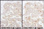 Beta-Arrestin 2 Polyclonal Antibody
