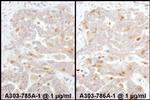 Beta-Arrestin 2 Polyclonal Antibody