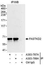 FASTKD2 Polyclonal Antibody
