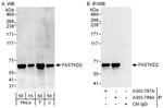 FASTKD2 Polyclonal Antibody