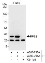 RPS2 Antibody in Immunoprecipitation (IP)