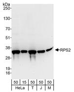 RPS2 Polyclonal Antibody