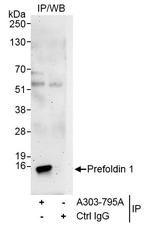 Prefoldin 1 Antibody in Immunoprecipitation (IP)