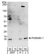 Prefoldin 1 Polyclonal Antibody