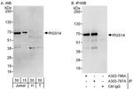 RGS14 Polyclonal Antibody