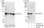 DYRK1A Polyclonal Antibody