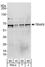 TRAF6 Polyclonal Antibody