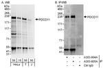PDCD11 Polyclonal Antibody
