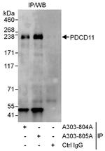 PDCD11 Antibody in Immunoprecipitation (IP)