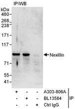 Nexilin Polyclonal Antibody