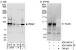 RANK Polyclonal Antibody