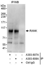 RANK Polyclonal Antibody