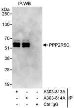 PPP2R5C Polyclonal Antibody