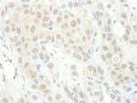 PPP2R5C Polyclonal Antibody