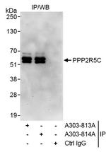 PPP2R5C Antibody in Immunoprecipitation (IP)