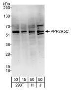 PPP2R5C Antibody in Western Blot (WB)