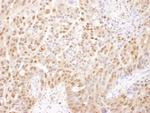 PSMA2 Antibody in Immunohistochemistry (Paraffin) (IHC (P))